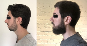 Screenshot 2026-03-22 182330.png